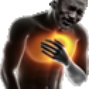 Mjlol chest pain